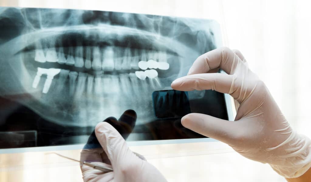 dental x-rays massachusetts