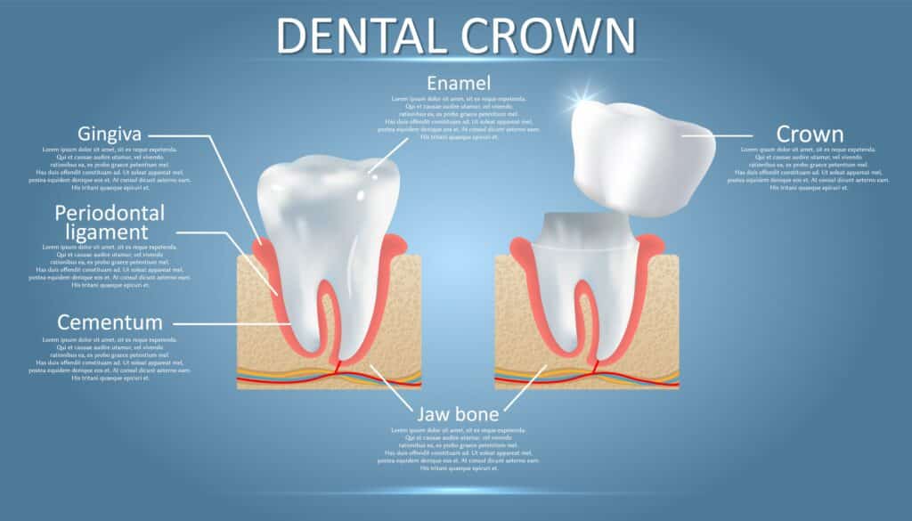 dental emergency