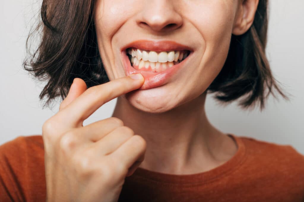 periodontics specialist in Marlborough